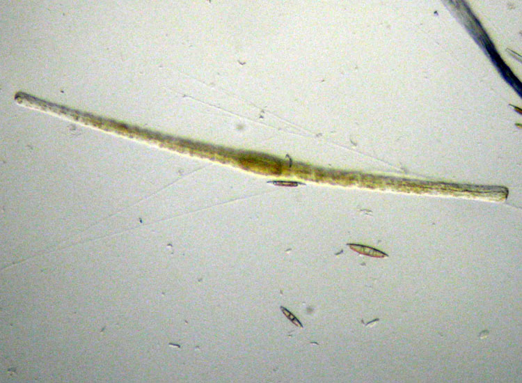 Diatomea marina: Toxarium undulatum, forse